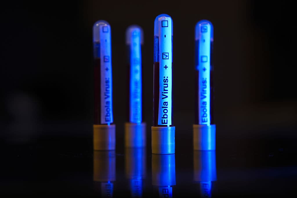 Race for rapid Ebola test narrows to five potential manufacturers