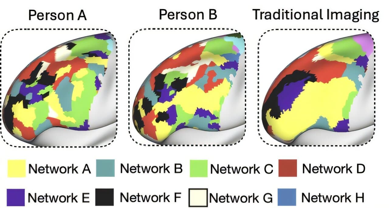Precision fMRI maps prefrontal cortex in individuals, revealing fine-scale structures