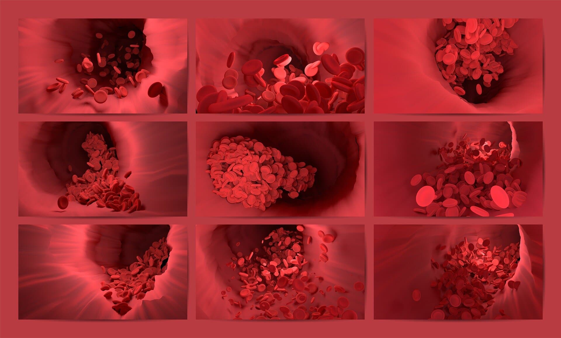 AI tool can identify biological profiles associated with thrombosis risk