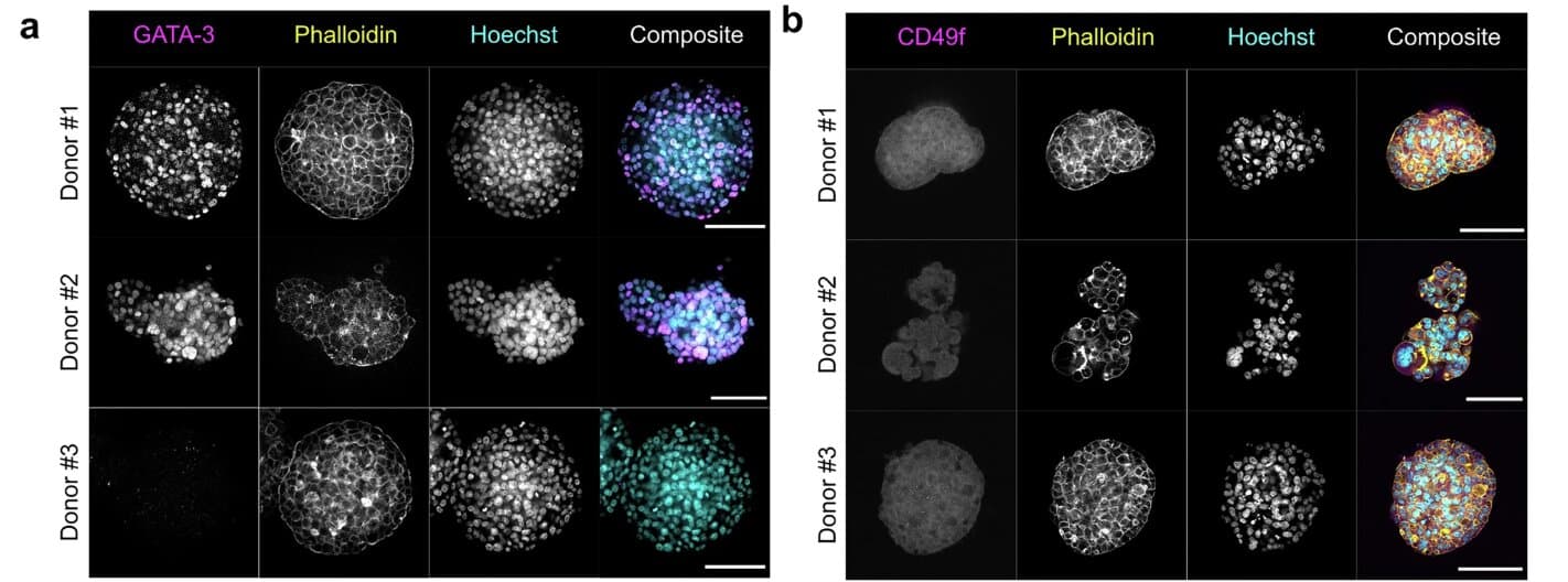 Forcing cancer cells to die can alert the immune system to enhance anti-tumor attack