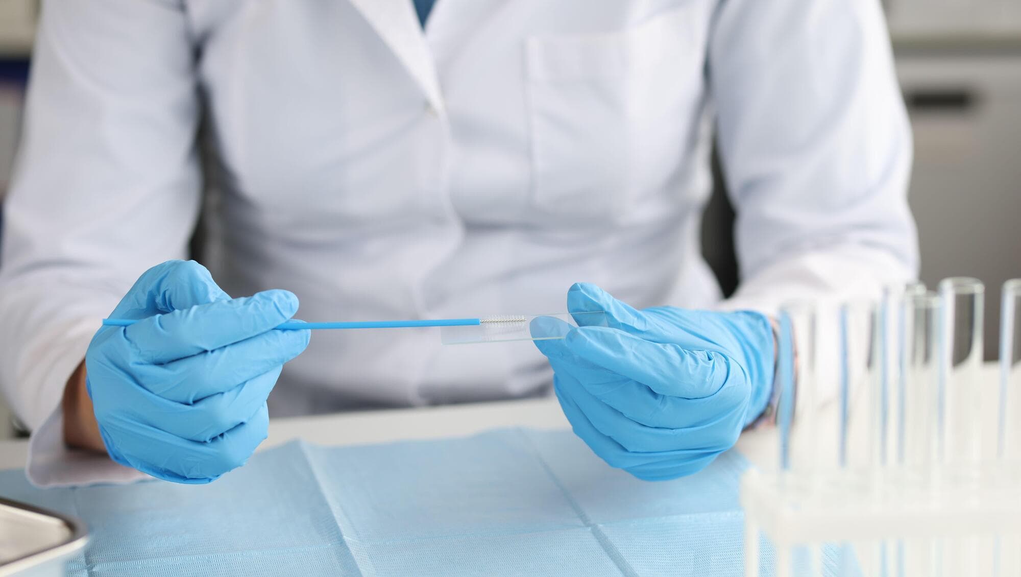 Cancer care systems ‘are struggling’ to keep up with rising patient numbers, experts warn