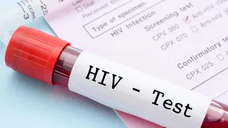 महिलाओं से अधिक पुरुष निकले HIV पॉजिटिव: पीलीभीत मेडिकल कॉलेज की रिपोर्ट ने बढ़ाई चिंता